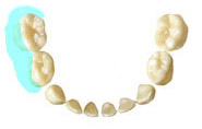 3.下顎右側　乳歯の奥歯の外側の面