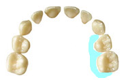 18.上顎左側　乳歯の奥歯の内側の面