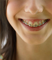 歯列矯正は、美しくなれば良いというものではありません。本当の意味を知り、治療に取り組みましょう