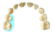 20.上顎右側　乳歯の奥歯の内側の面