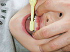 14.上顎前歯　表側の面前歯から左奥へ