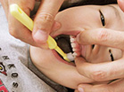 17.上顎左側　乳歯の奥歯の物を噛む面